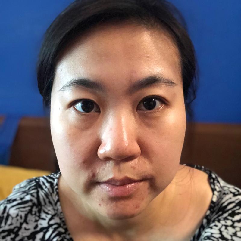 孕酮低于多少是宫外孕 孕酮低于多少是宫外孕