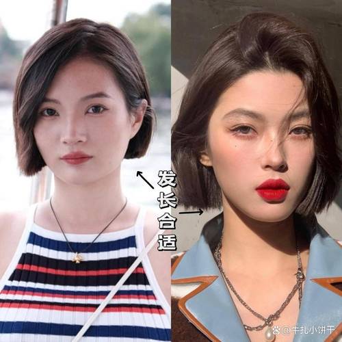 神经性头痛的治疗方法 神经性头痛的治疗方法