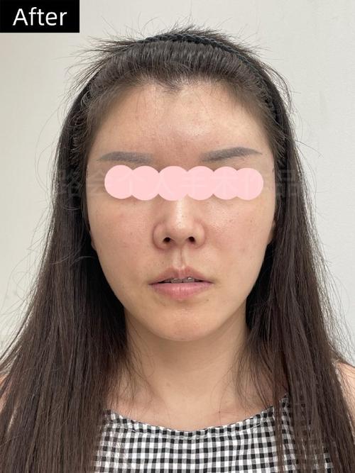 健尔马辅酶q10的作用与功效 健尔马辅酶q10的三大作用 健尔马辅酶q10的作用与功效 健尔马辅酶q10的三大作用