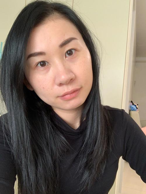 肾结石应该多吃什么 肾结石应该多吃什么