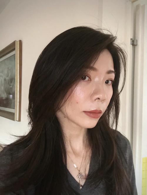 脂肪填充82天还能吸收吗 脂肪填充82天还能吸收吗