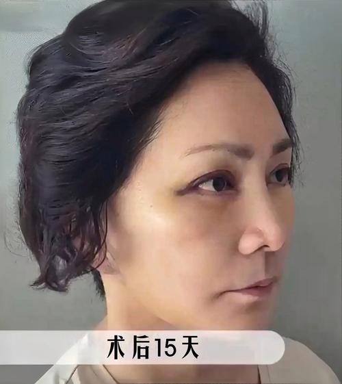 儿童蛀牙需要补吗 蛀牙修复刻不容缓 儿童蛀牙需要补吗 蛀牙修复刻不容缓