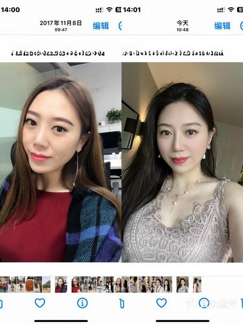 婴儿湿疹最佳治疗方法 这三个方法效果好 婴儿湿疹最佳治疗方法 这三个方法效果好