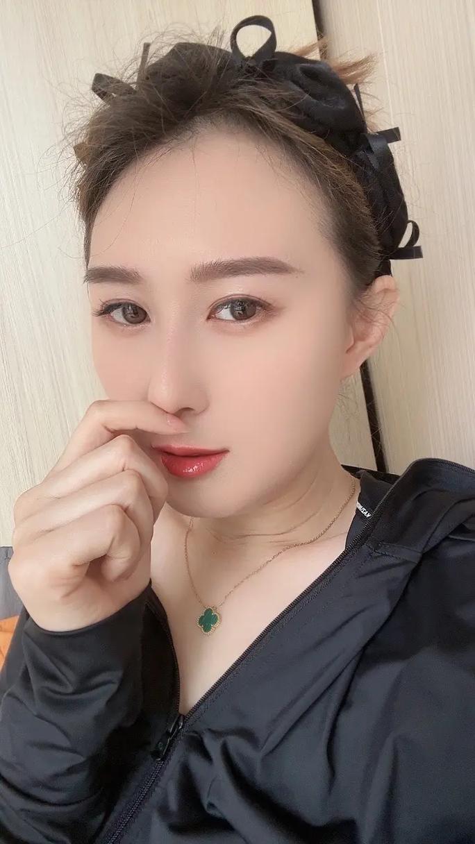 脂溢性脱发怎么调理 脂溢性脱发饮食原则 脂溢性脱发怎么调理 脂溢性脱发饮食原则