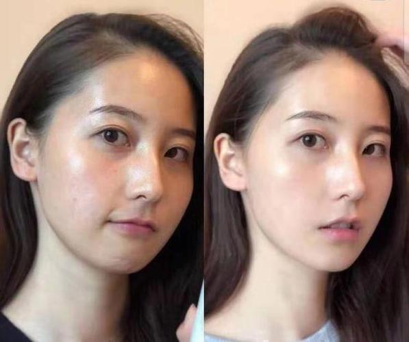 Ѫѹʲôʱ׼ȷ Ѫѹע