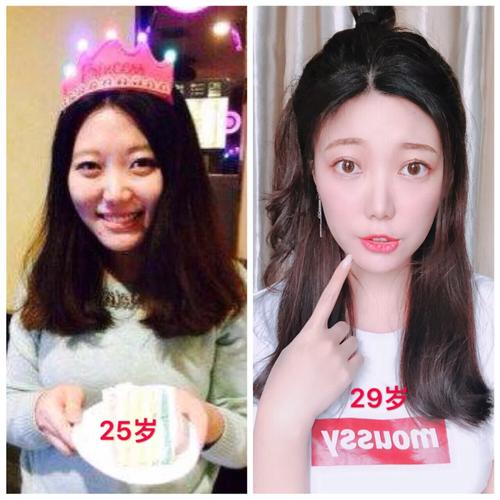 脂肪肝浸润怎么回事 脂肪肝浸润怎么回事