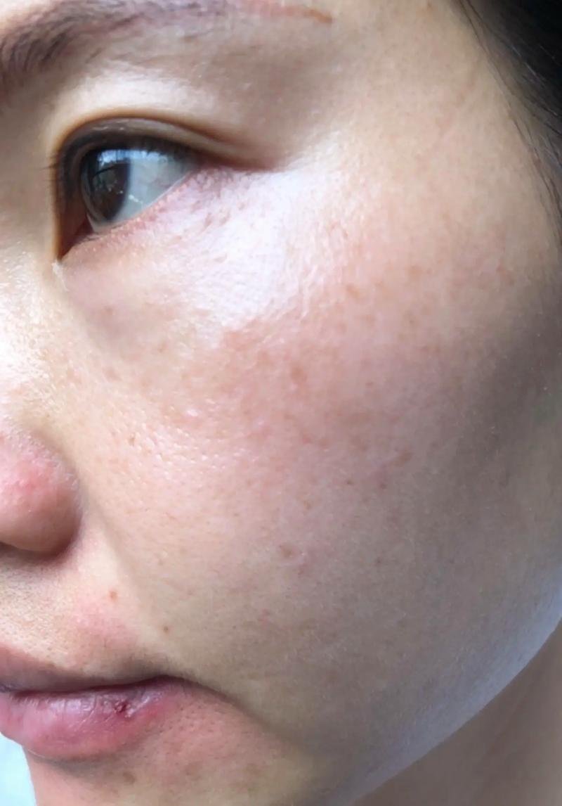 ֬���γ�ʲôˮ����